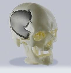 Porcellana Il servizio di stampa professionale di SLS 3D ha personalizzato le parti di plastica per i prodotti medici fornitore